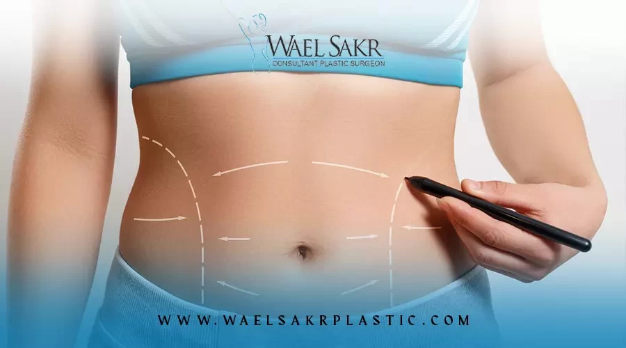 اسعار عمليات الشد بعد التكميم image