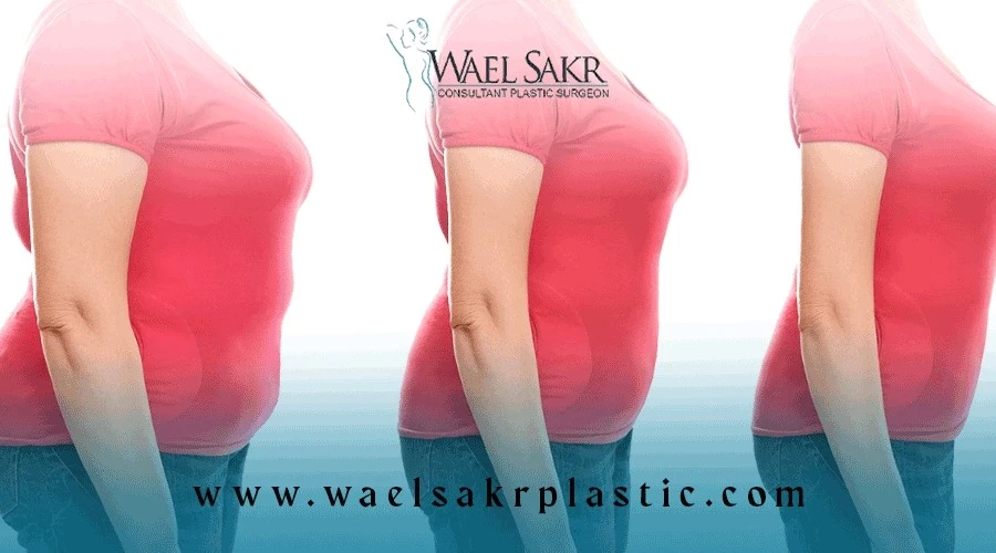 اسعار عمليات تنسيق القوام في مصر image